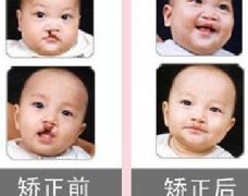 吃兔肉真的會長兔唇？為什么會長兔唇？